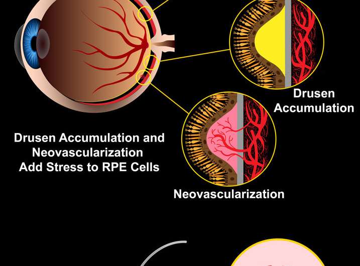 Researchers develop new devices to test retinal cells