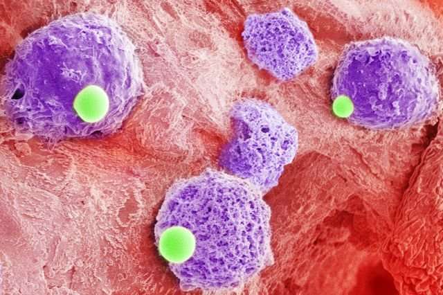 Researchers design delivery system to guide drugs directly to cancer cells ‘hiding’ in bone marrow