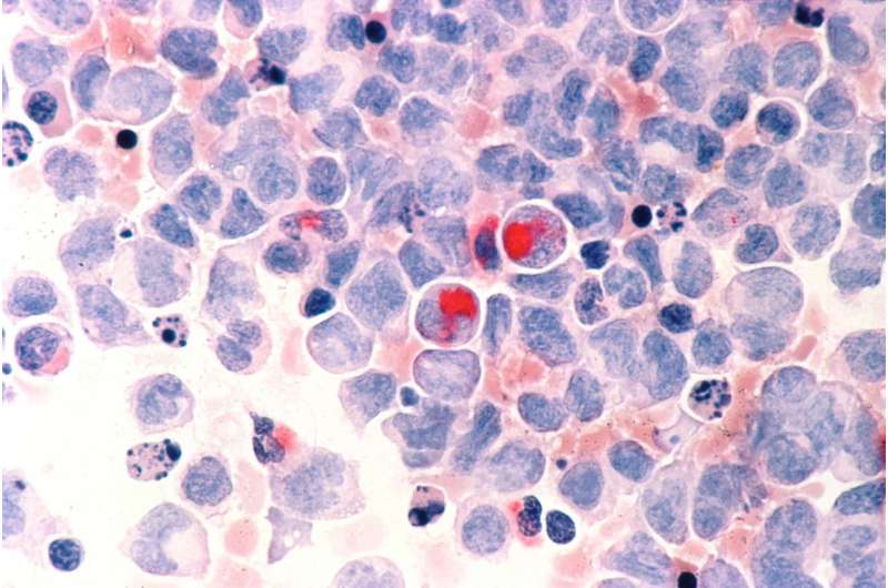 Scientists can predict rare leukaemia 8 years before symptoms begin