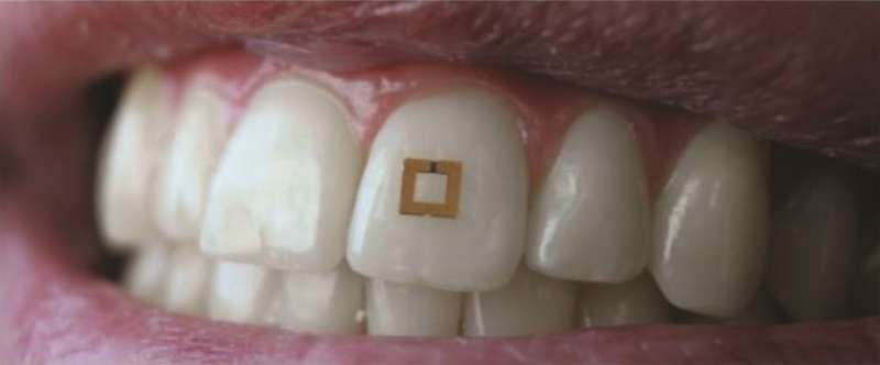 Scientists develop tiny tooth-mounted sensors that can track what you eat