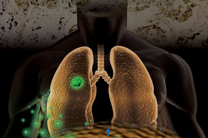 Study suggests molecular imaging strategy for determining molecular classifications of NSCLC