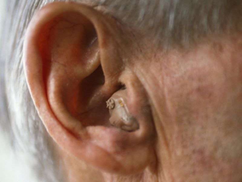 心血管疾病与老年人听力损失有关