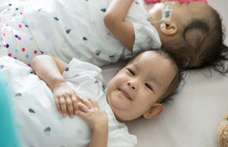 Conjoined twins Nima and Dawa—whose names mean &quot;Sun&quot; and &quot;Moon&quot;—were separated on November 9 at the Royal Ch