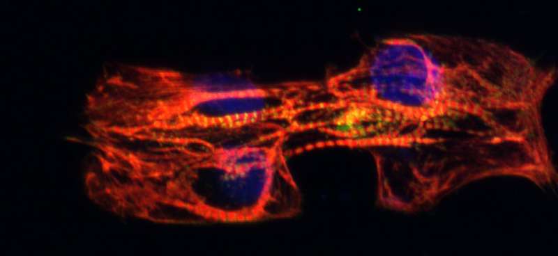 Mending broken hearts with cardiomyocyte molds