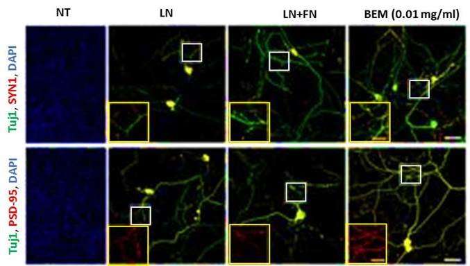Neuroengineering in Three-dimensional Brain-like Microenvironments