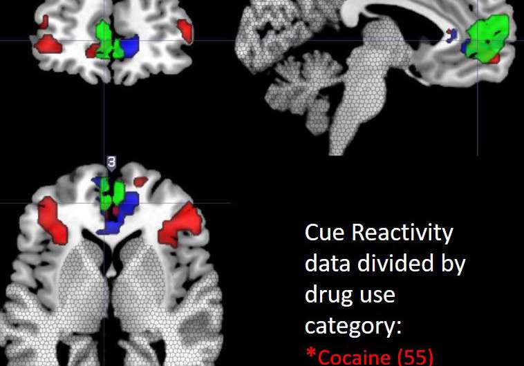 Neuroimaging study reveals 'hot spot' for cue-reactivity in substance-dependent population