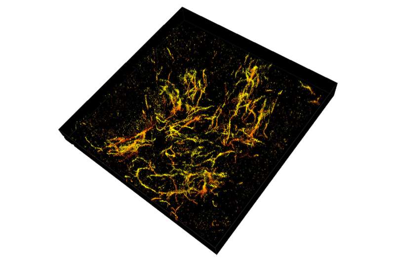 New development in 3D super-resolution imaging gives insight on Alzheimer's disease