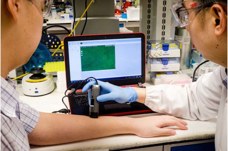 New nanoparticles help to detect serious scarring of wounds