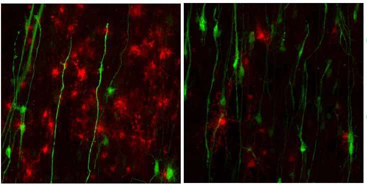New stem cell model can be used to test treatments for a rare nervous system disorder