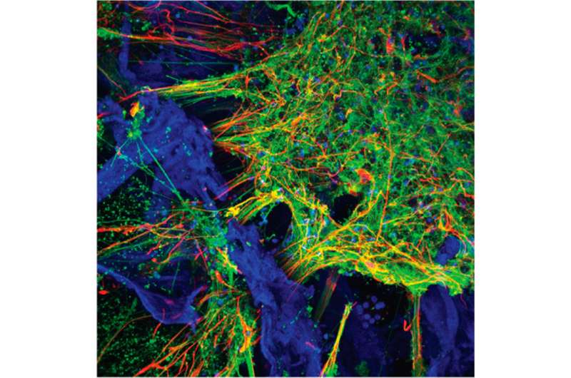 Scientists grow functioning human neural networks in 3D from stem cells