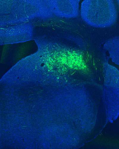 Scientists identify brain region in mice that keeps the body from losing its balance