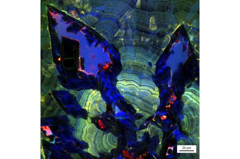 Study: Kidney stones have distinct geological histories