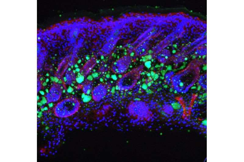 UC San Diego researchers identify how skin ages, loses fat and immunity