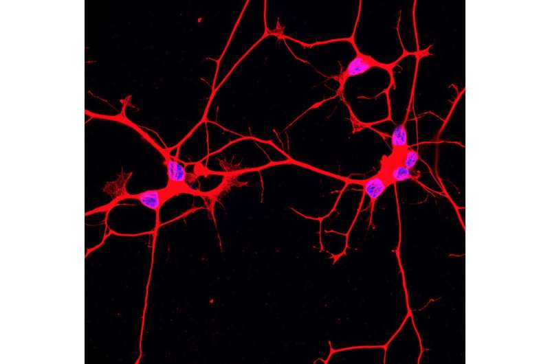 New technique helps uncover changes in ALS neurons