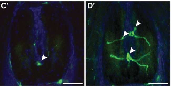 Researchers discover an immune response associated with the development of idiopathic scoliosis (IS) in zebrafish