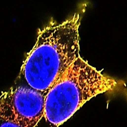 Researchers reveal miscarriage cause, key cellular targets of potential drugs