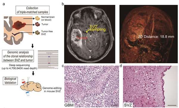 A breakthrough for understanding glioblastoma—origin cells for deadly brain tumors identified