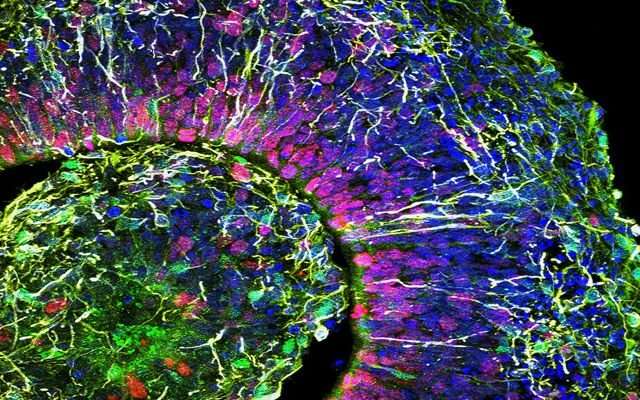 Building a better brain-in-a-dish, faster and cheaper