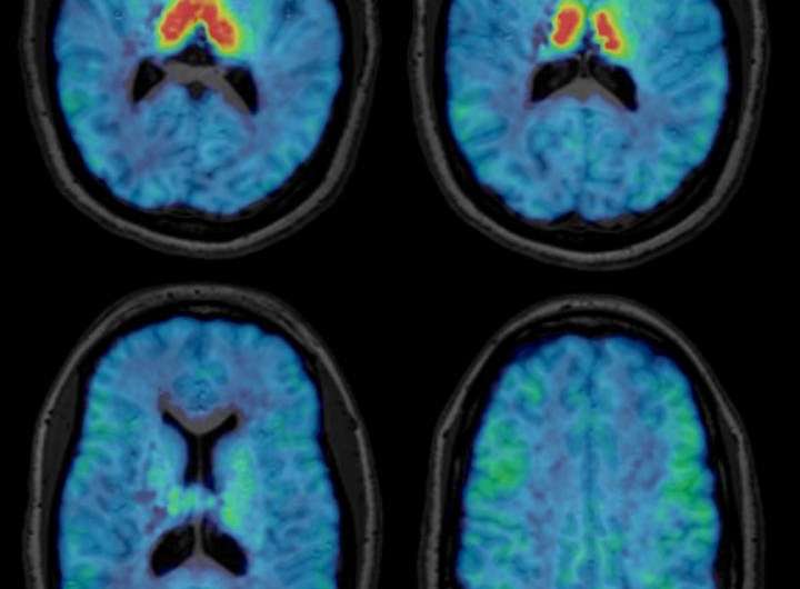 New nuclear medicine tracer will help study the aging brain