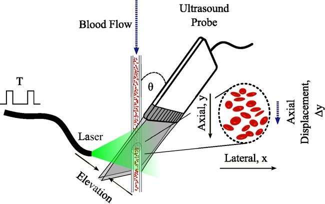 New research reports advances in measuring blood flow velocity in deep tissue