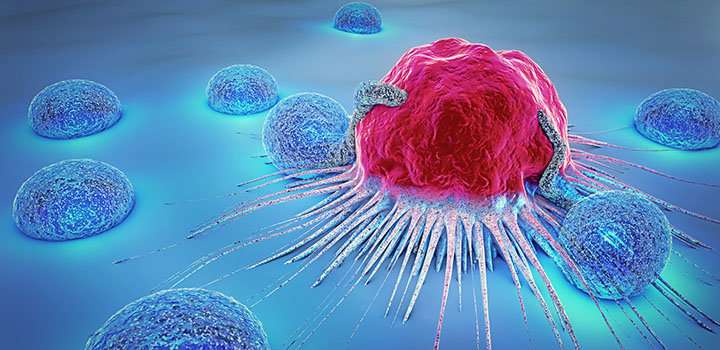 Research could help fine-tune cancer treatment