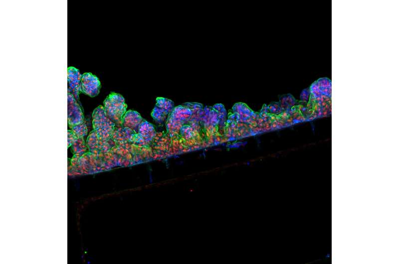 Scientists produce human intestinal lining that re-creates living tissue inside organ-chip