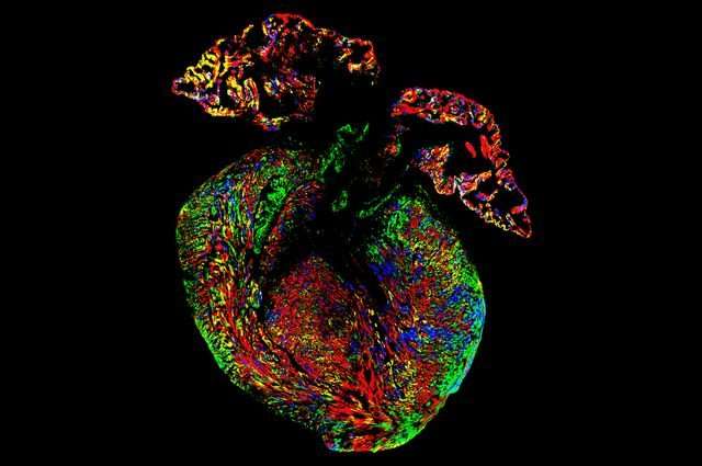 Scientists use color-coded tags to discover how heart cells develop
