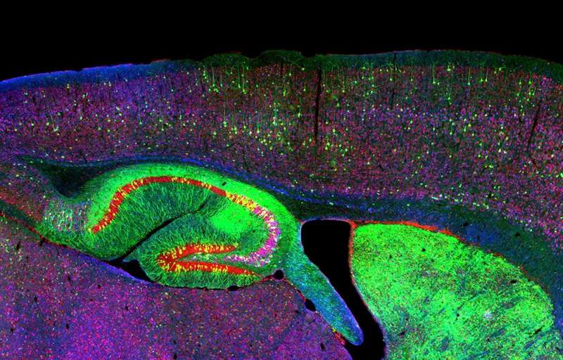有争议的发现成人的大脑不生长新的神经元