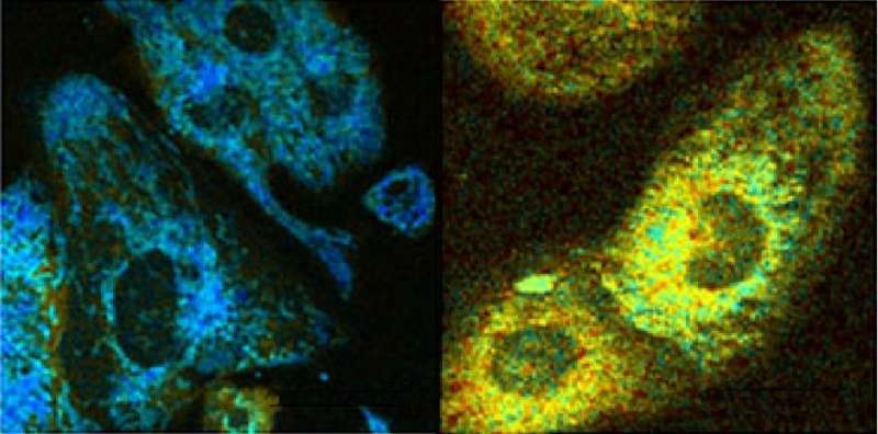 Researchers develop optical tools to detect metabolic changes linked to disease