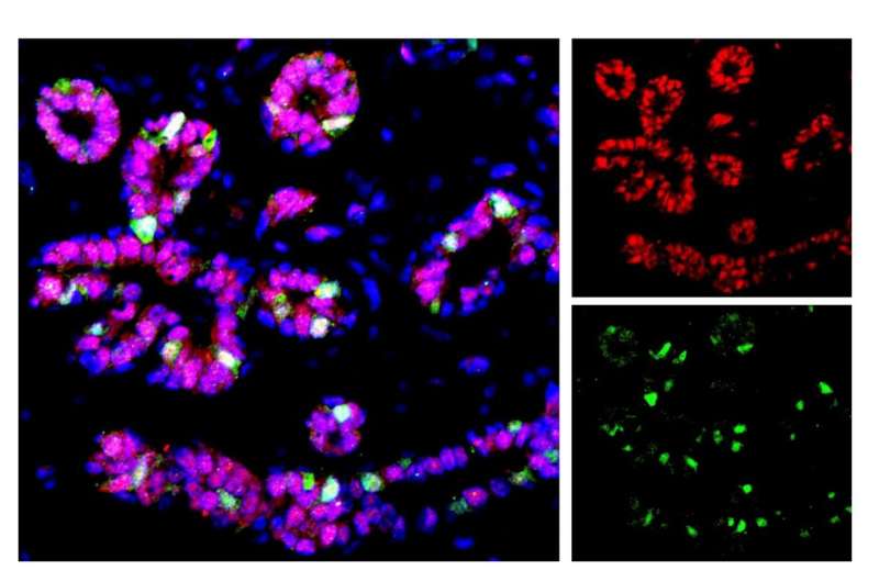 Researchers uncover cell types of the human breast epithelium