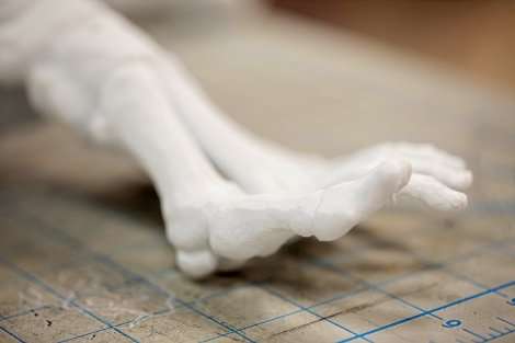 3-D-printed bones are helping doctors prepare for surgeries
