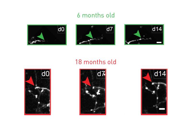 Antidepressant restores youthful flexibility to aging inhibitory neurons in mice