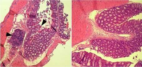 Defense against intestinal infection in organism is affected by prostaglandin E2