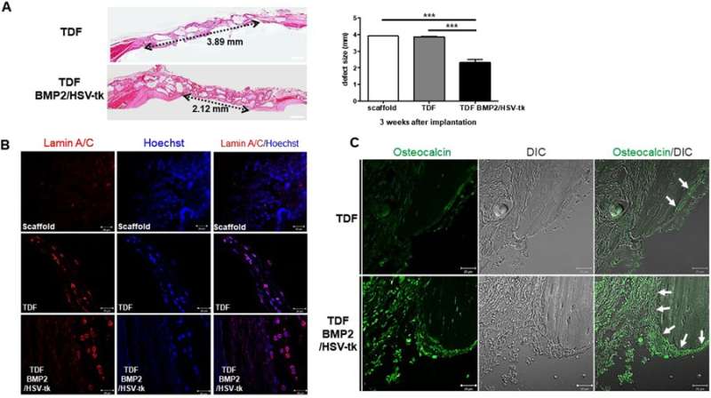 **Engineering teratoma-derived fibroblasts to enhance osteogenesis