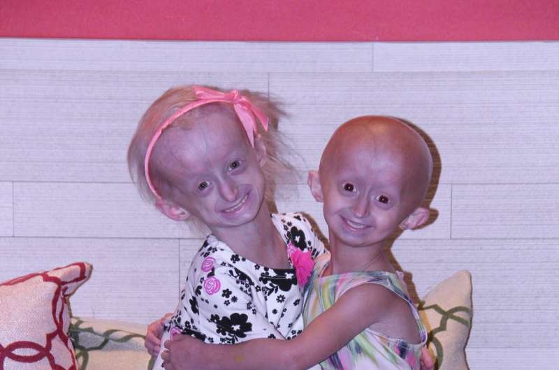 Experimental drug extends survival in progeria