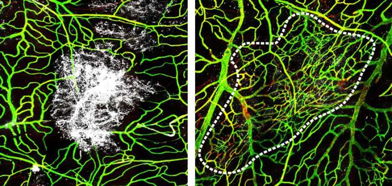NIH scientists watch the brain's lining heal after a head injury