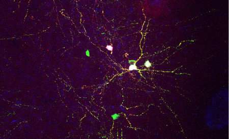 Research reveals how brains develop the right mix of cells