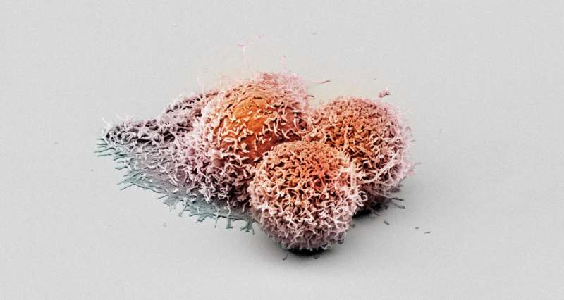 Researchers discover new anti-cancer protein