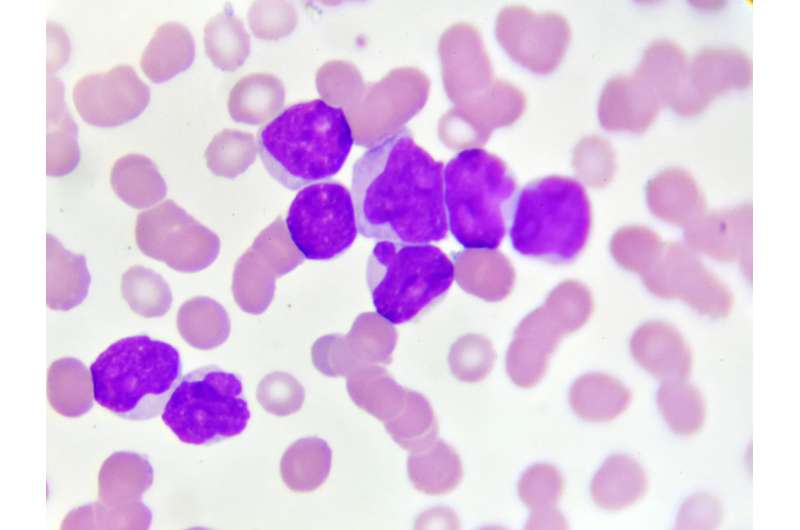 FDA approves new targeted drug for leukemia tested at University of Pennsylvania