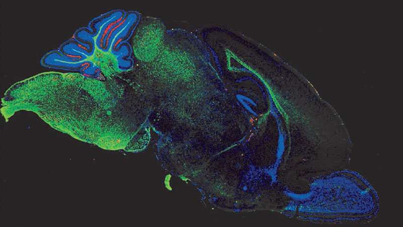 Johns Hopkins researchers find the cause of and cure for brain injury associated with gut condition