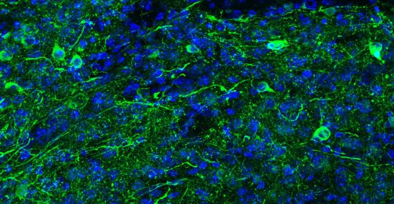 Scientists accidentally reprogram mature mouse GABA neurons into dopaminergic-like neurons