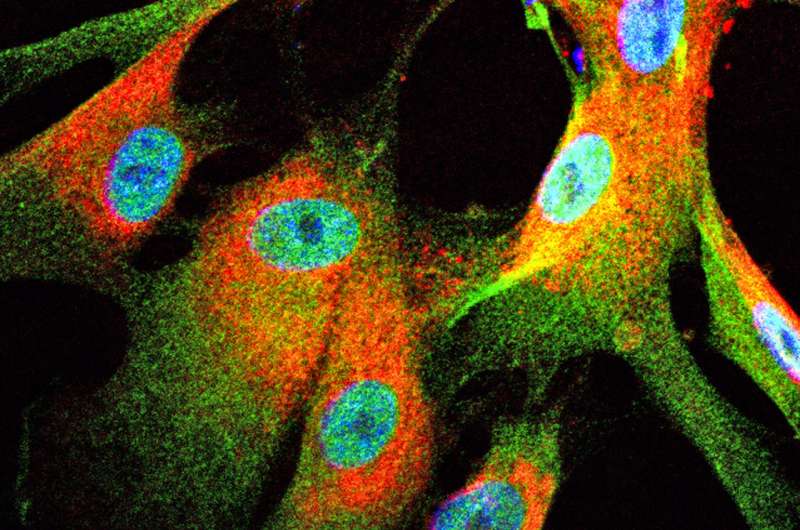 Study suggests way to attack deadly, untreatable nerve tumors