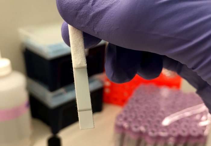 Quick HIV detection method could diagnose early disease