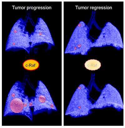 Researchers discover a potential new therapeutic strategy for pancreatic cancer