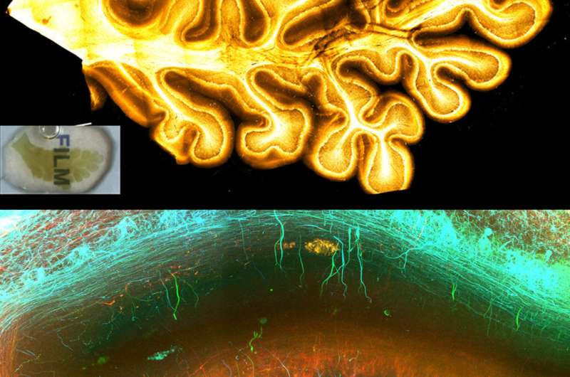 New tissue technique gives stunning 3-D insights into the human brain