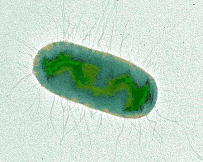 Zinc is able to modulate Escherichia coli bacteria’s virulence, study finds