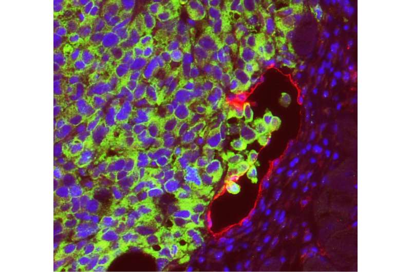 Lymphatic endothelial cells promote melanoma to spread