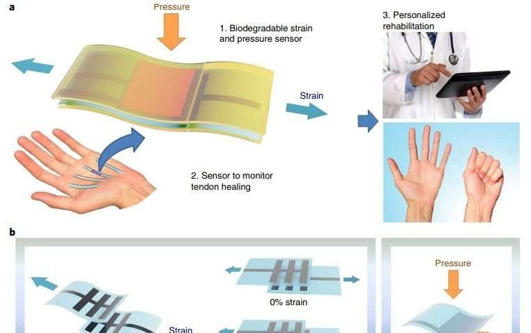 Implantable sensor decomposes when its usefulness ends