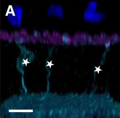 Selective neural connections can be reestablished in retina after injury, study finds