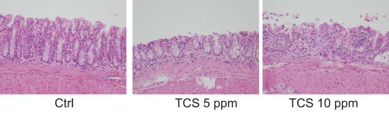 Mouse study links triclosan, a common antimicrobial, to colonic inflammation
